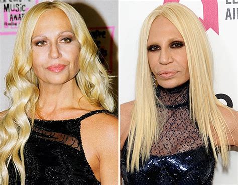 donatela versace antes y despues|donatella versace edad.